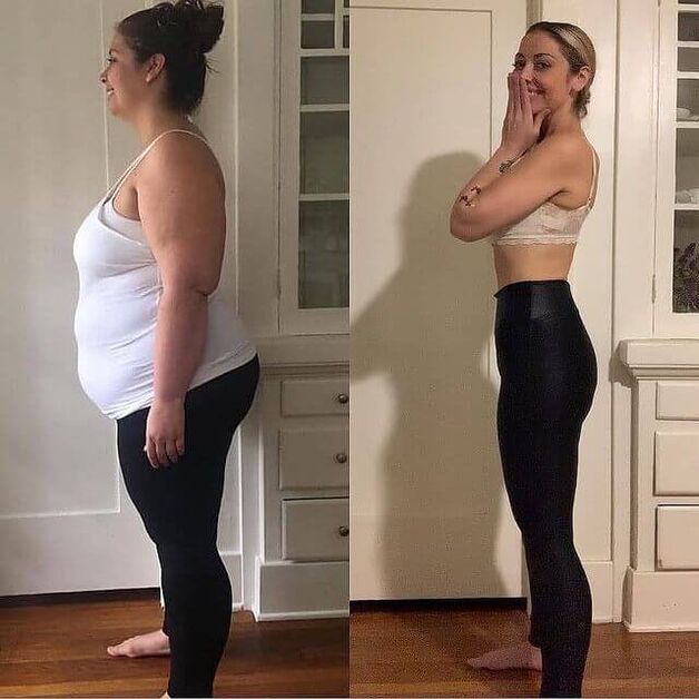 Woman before and after the abslim